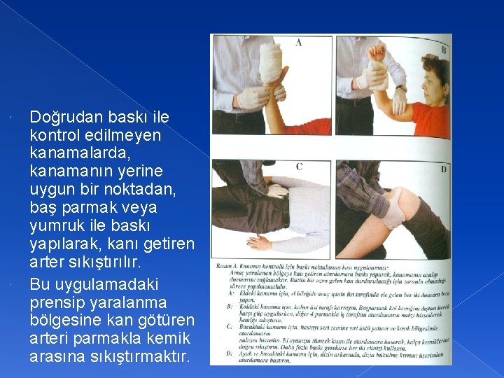 Doğrudan baskı ile kontrol edilmeyen kanamalarda, kanamanın yerine uygun bir noktadan, baş parmak veya