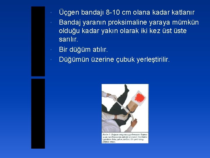 Üçgen bandajı 8 -10 cm olana kadar katlanır Bandaj yaranın proksimaline yaraya mümkün olduğu