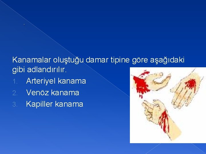 . Kanamalar oluştuğu damar tipine göre aşağıdaki gibi adlandırılır. 1. Arteriyel kanama 2. Venöz