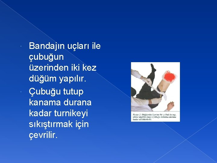 Bandajın uçları ile çubuğun üzerinden iki kez düğüm yapılır. Çubuğu tutup kanama durana kadar