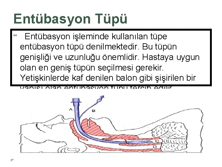 Entübasyon Tüpü Entübasyon işleminde kullanılan tüpe entübasyon tüpü denilmektedir. Bu tüpün genişliği ve uzunluğu