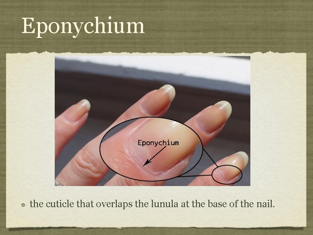 Eponychium the cuticle that overlaps the lunula at the base of the nail. 