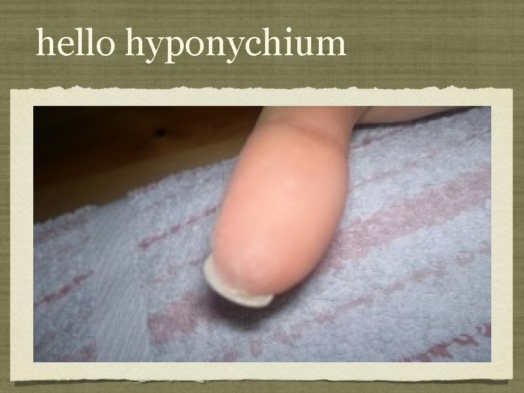hello hyponychium 