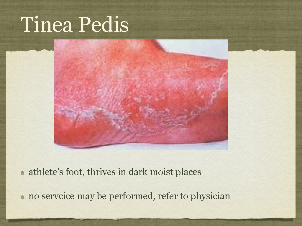 Tinea Pedis athlete’s foot, thrives in dark moist places no servcice may be performed,