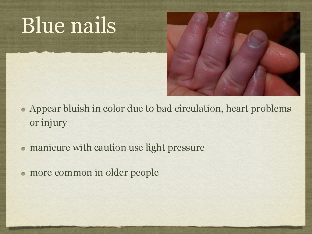 Blue nails Appear bluish in color due to bad circulation, heart problems or injury