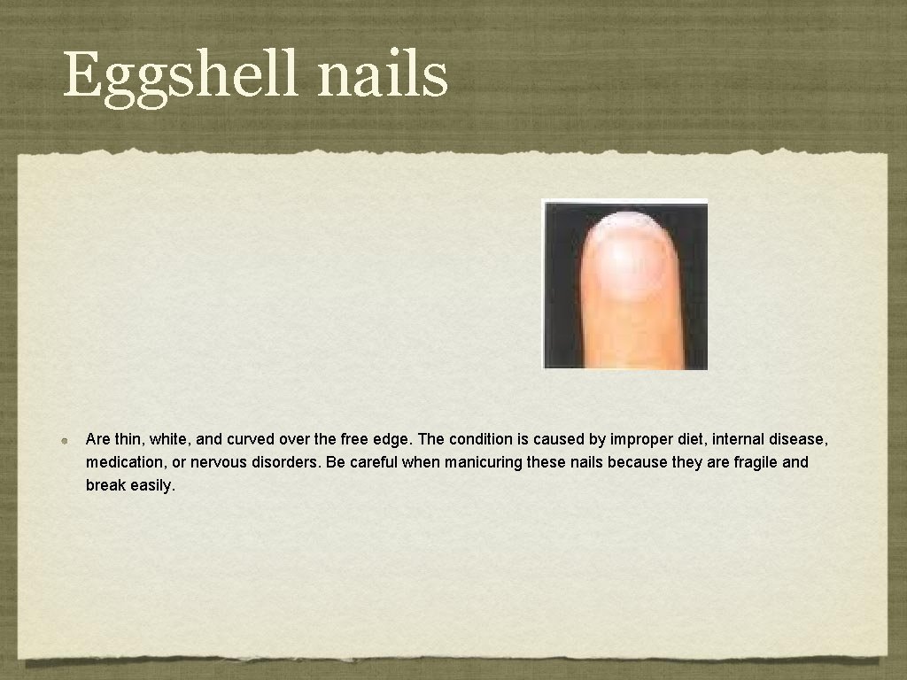 Eggshell nails Are thin, white, and curved over the free edge. The condition is