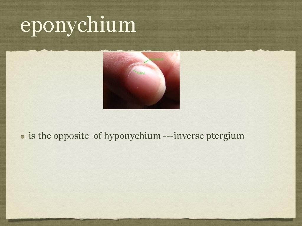 eponychium is the opposite of hyponychium ---inverse ptergium 