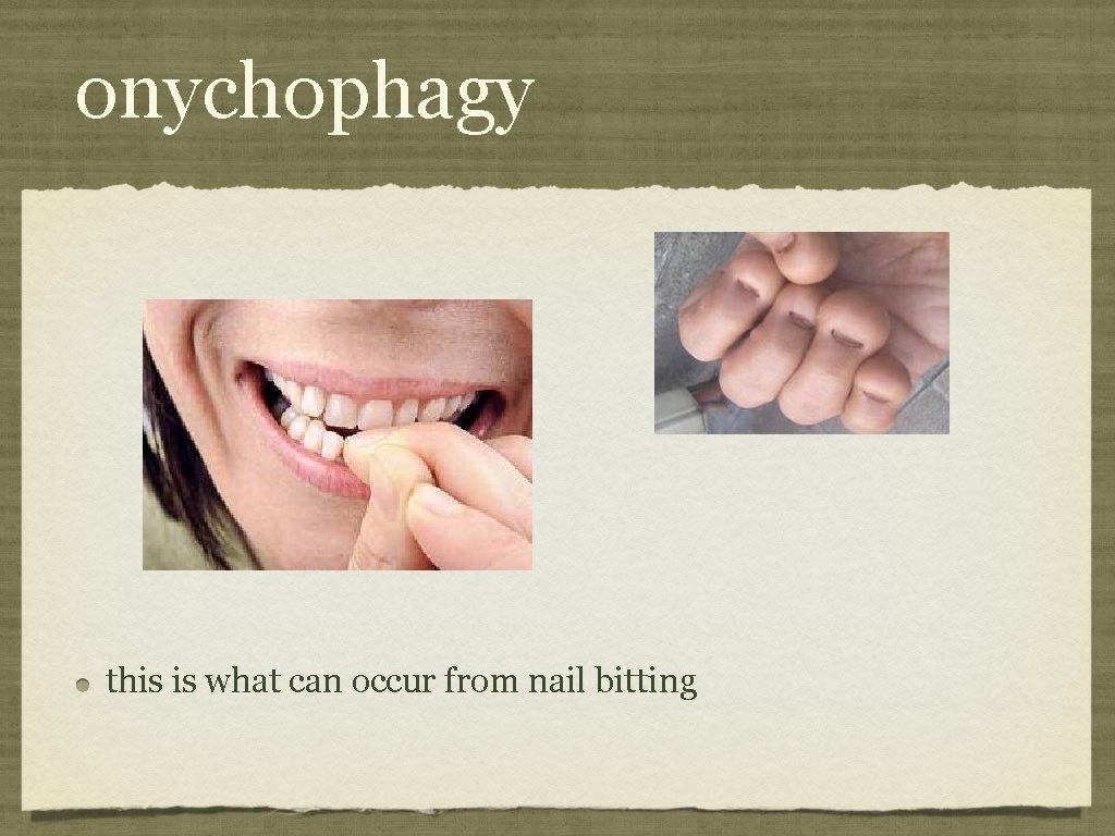 onychophagy this is what can occur from nail bitting 