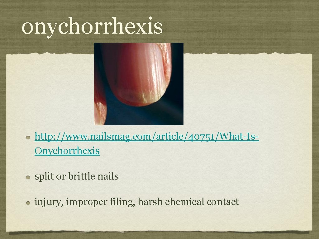 onychorrhexis http: //www. nailsmag. com/article/40751/What-Is. Onychorrhexis split or brittle nails injury, improper filing, harsh