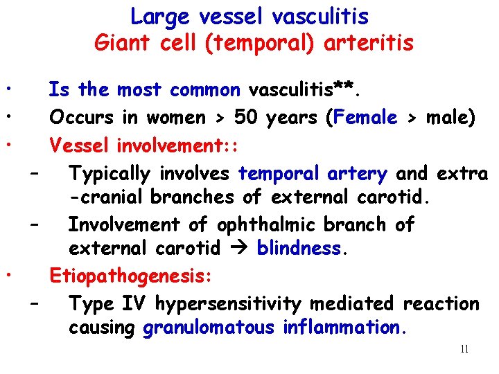 Large vessel vasculitis Giant cell (temporal) arteritis • • • Is the most common