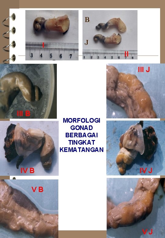 B I J II III J III B MORFOLOGI GONAD BERBAGAI TINGKAT KEMATANGAN IV