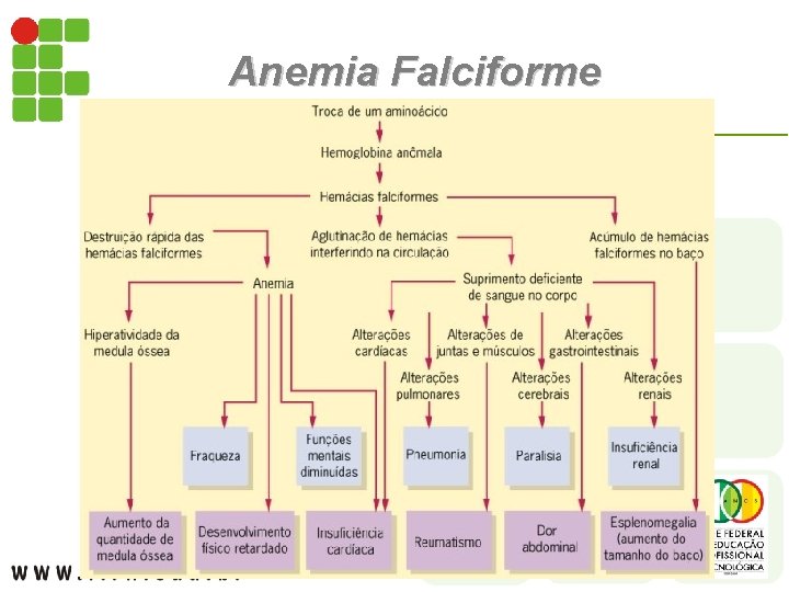 Anemia Falciforme 