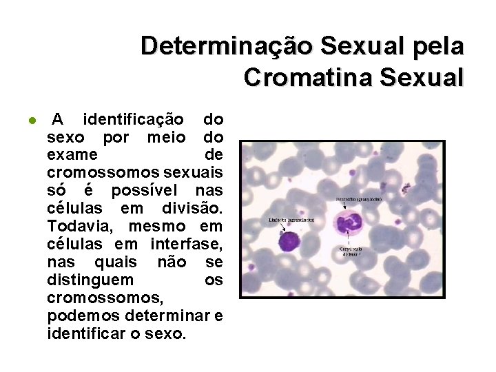 l Determinação Sexual pela Cromatina Sexual identificação do A sexo por meio do exame