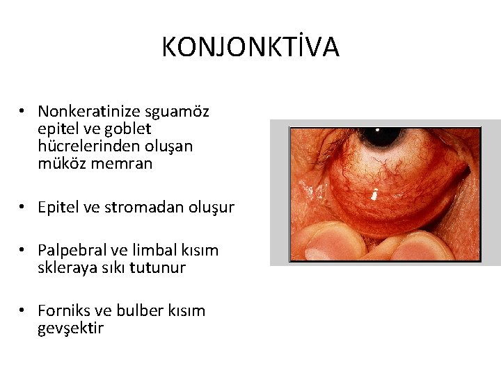 KONJONKTİVA • Nonkeratinize sguamöz epitel ve goblet hücrelerinden oluşan müköz memran • Epitel ve