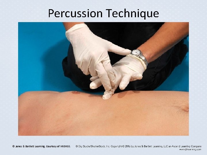 Percussion Technique © Jones & Bartlett Learning. Courtesy of MIEMSS. Percussion Technique © Jones & Bartlett Learning. Courtesy of MIEMSS.