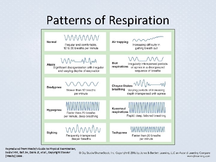Patterns of Respiration Reproduced from Mosby’s Guide to Physical Examination, Seidel HM, Ball JW, Patterns of Respiration Reproduced from Mosby’s Guide to Physical Examination, Seidel HM, Ball JW,