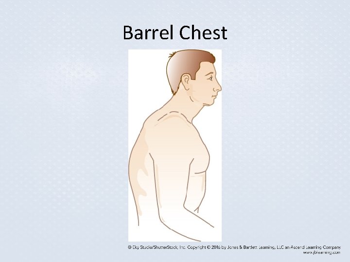 Barrel Chest Barrel Chest