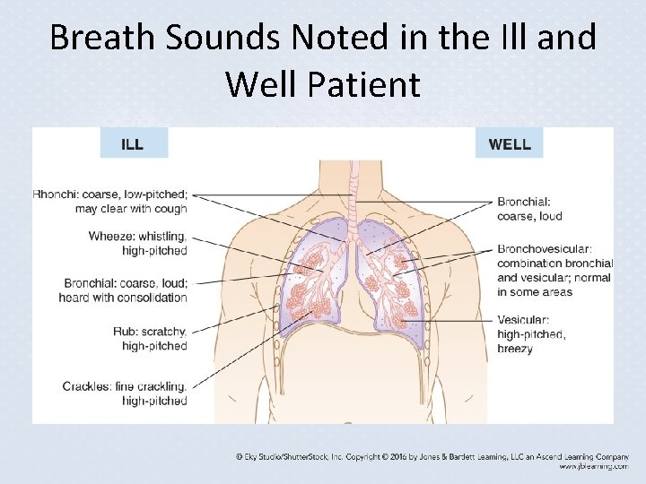 Breath Sounds Noted in the Ill and Well Patient Breath Sounds Noted in the Ill and Well Patient