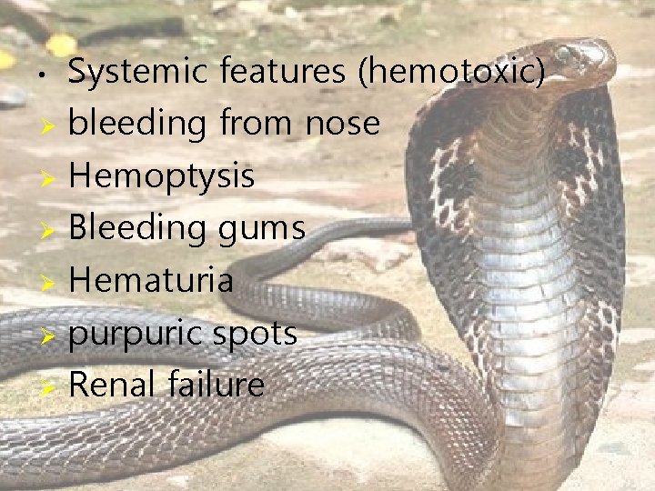 Systemic features (hemotoxic) Ø bleeding from nose Ø Hemoptysis Ø Bleeding gums Ø Hematuria