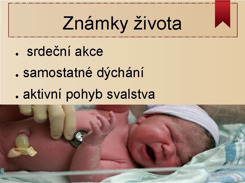 Známky života ● srdeční akce ● samostatné dýchání ● aktivní pohyb svalstva 