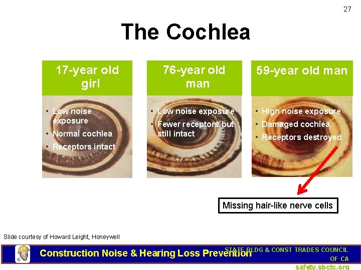 27 The Cochlea 17 -year old girl • Low noise exposure • Normal cochlea