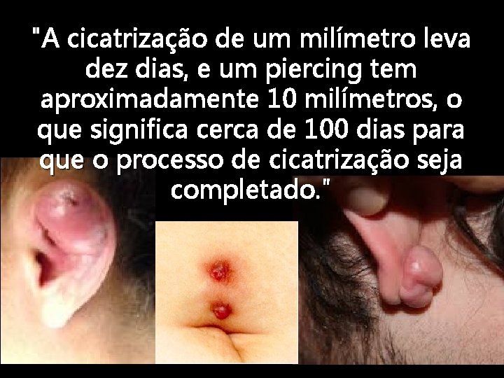 "A cicatrização de um milímetro leva dez dias, e um piercing tem aproximadamente 10