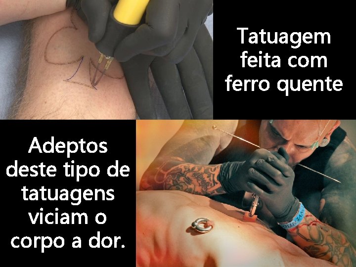 Tatuagem feita com ferro quente Adeptos deste tipo de tatuagens viciam o corpo a