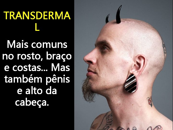 TRANSDERMA L Mais comuns no rosto, braço e costas. . . Mas também pênis