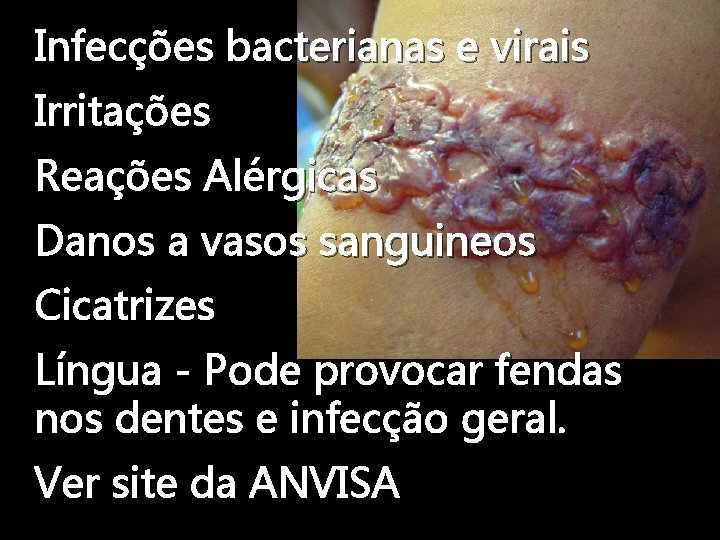 Infecções bacterianas e virais Irritações Reações Alérgicas Danos a vasos sanguineos Cicatrizes Língua -