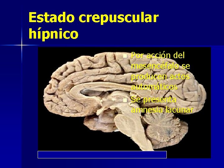 Estado crepuscular hípnico n n Por acción del mesencéfalo se producen actos automáticos Se