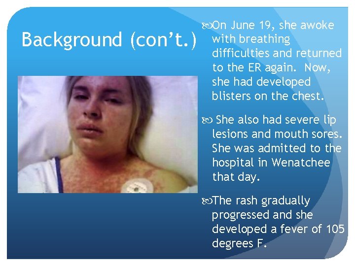 Background (con’t. ) On June 19, she awoke with breathing difficulties and returned to