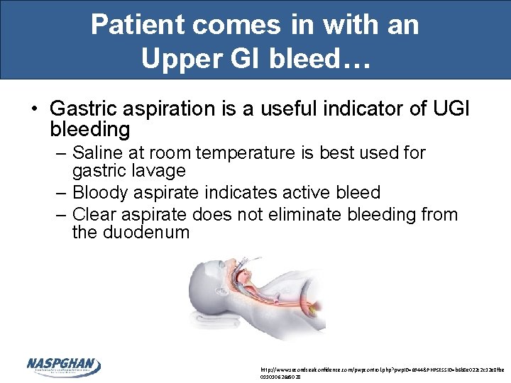 Patient comes in with an Upper GI bleed… • Gastric aspiration is a useful