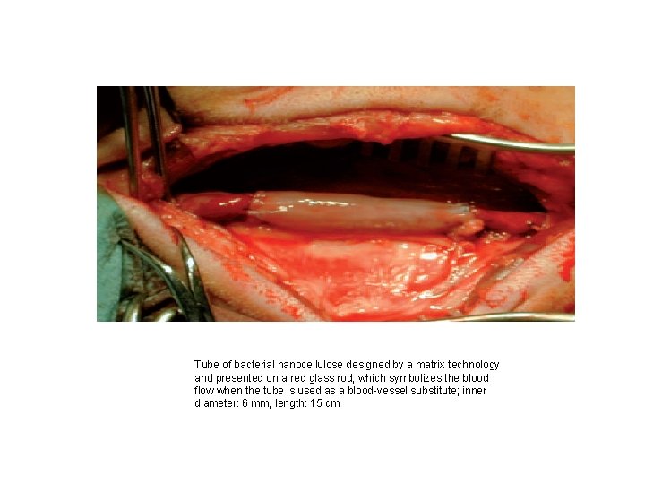 Tube of bacterial nanocellulose designed by a matrix technology and presented on a red