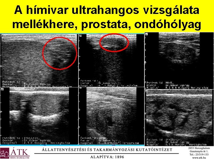 A hímivar ultrahangos vizsgálata mellékhere, prostata, ondóhólyag 