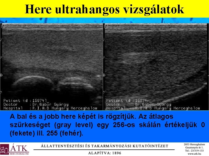 Here ultrahangos vizsgálatok A bal és a jobb here képét is rögzítjük. Az átlagos