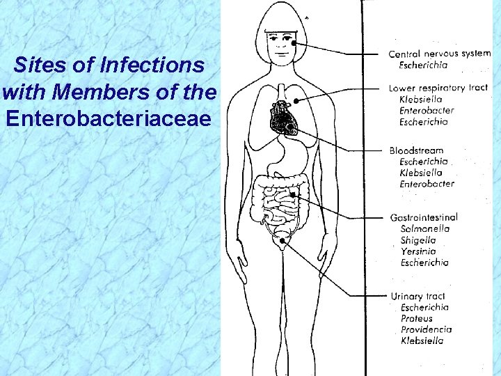 Sites of Infections with Members of the Enterobacteriaceae 