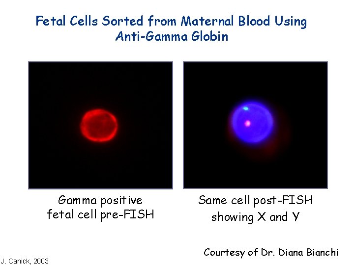 Fetal Cells Sorted from Maternal Blood Using Anti-Gamma Globin Gamma positive fetal cell pre-FISH
