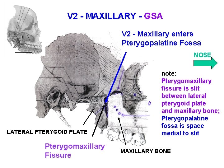 V 2 - MAXILLARY - GSA V 2 - Maxillary enters Pterygopalatine Fossa NOSE