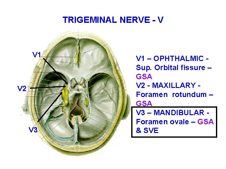 TRIGEMINAL NERVE - V V 1 V 2 V 3 V 1 – OPHTHALMIC TRIGEMINAL NERVE - V V 1 V 2 V 3 V 1 – OPHTHALMIC