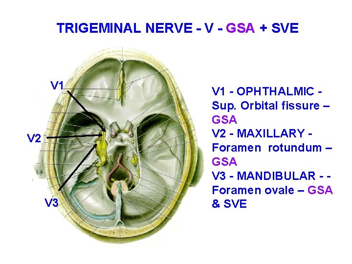 TRIGEMINAL NERVE - V - GSA + SVE V 1 V 2 V 3