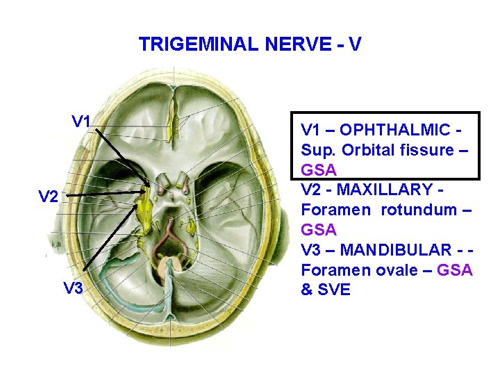 TRIGEMINAL NERVE - V V 1 V 2 V 3 V 1 – OPHTHALMIC