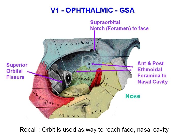 V 1 - OPHTHALMIC - GSA Supraorbital Notch (Foramen) to face Superior Orbital Fissure V 1 - OPHTHALMIC - GSA Supraorbital Notch (Foramen) to face Superior Orbital Fissure
