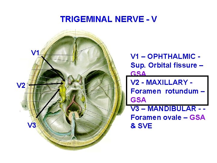 TRIGEMINAL NERVE - V V 1 V 2 V 3 V 1 – OPHTHALMIC