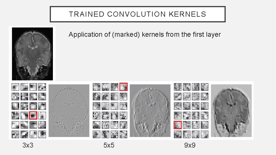 TRAINED CONVOLUTION KERNELS Application of (marked) kernels from the first layer 3 x 3