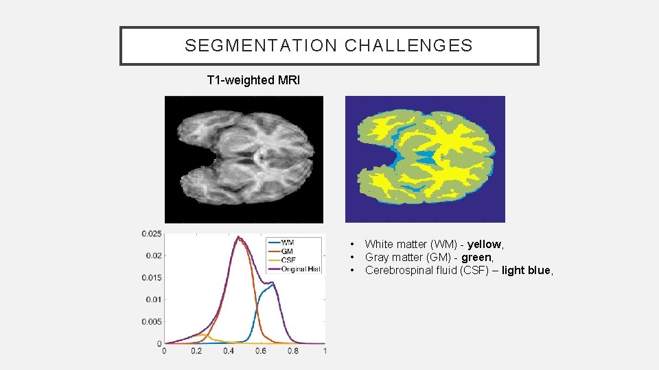 SEGMENTATION CHALLENGES T 1 -weighted MRI • • • White matter (WM) - yellow,