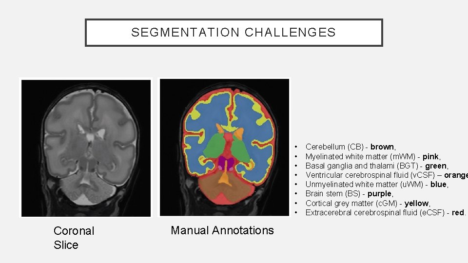 SEGMENTATION CHALLENGES • • Coronal Slice Manual Annotations Cerebellum (CB) - brown, Myelinated white