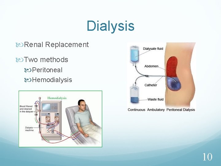 Dialysis Renal Replacement Two methods Peritoneal Hemodialysis 10 