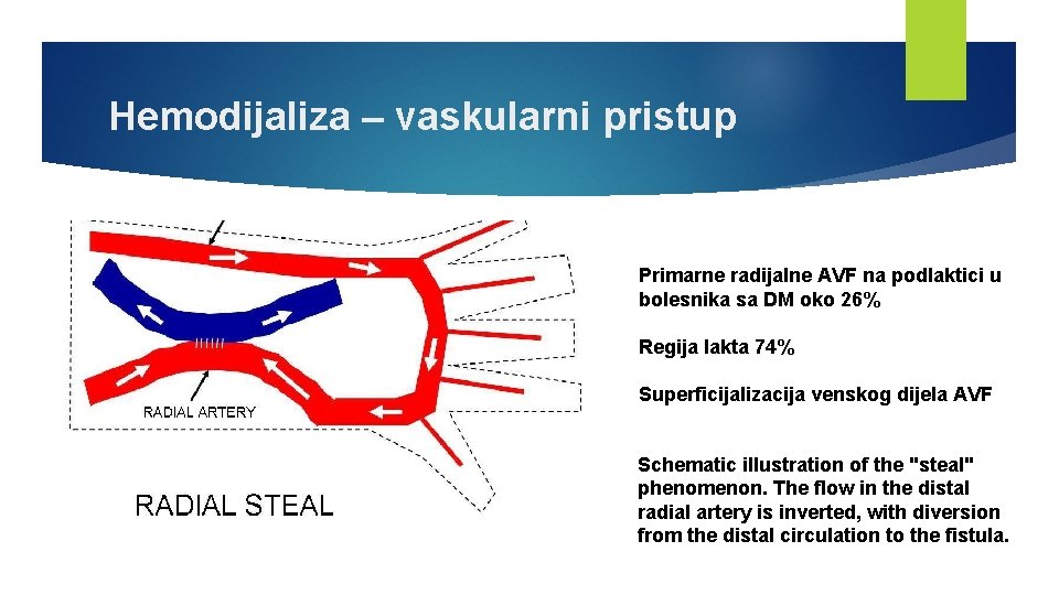 Hemodijaliza – vaskularni pristup Primarne radijalne AVF na podlaktici u bolesnika sa DM oko