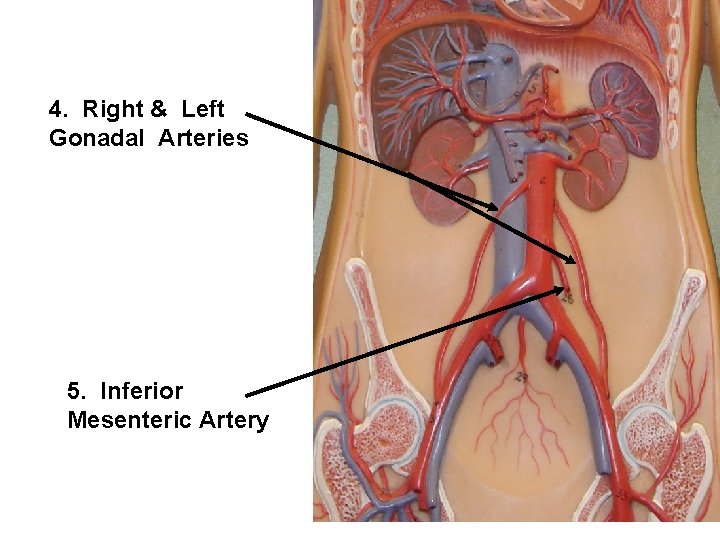 4. Right & Left Gonadal Arteries 5. Inferior Mesenteric Artery 
