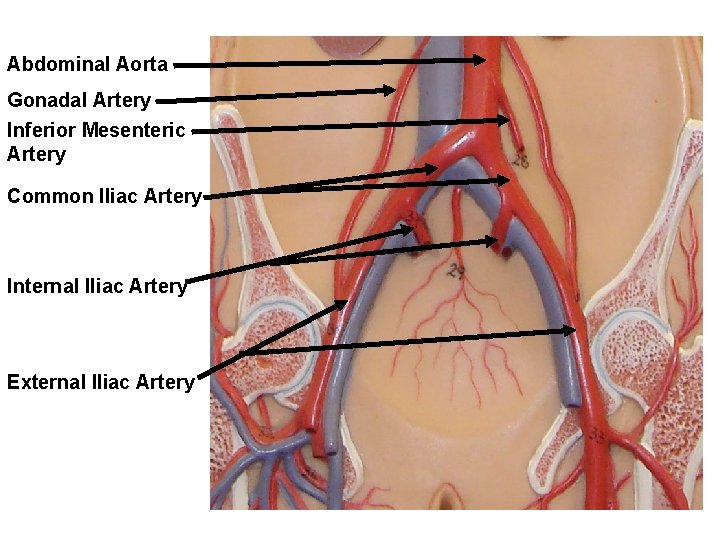 Abdominal Aorta Gonadal Artery Inferior Mesenteric Artery Common Iliac Artery Internal Iliac Artery External